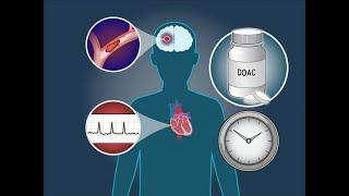 Anticoagulation Timing after Stroke in Atrial Fibrillation | NEJM