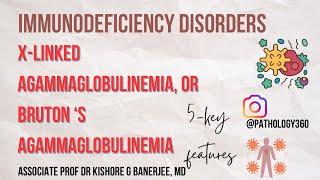 Immunodeficiency disorder : X-Linked Hypogammaglobulinemia (XLA) or BRUTON’S Hypogammaglobulinemia