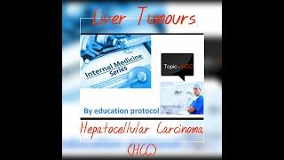 Liver tumours-1 Hepatocellular carcinoma (HCC)