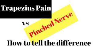 Pinched Nerve versus Trapezius Pain (HOW TO TELL)