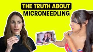 Erase Wrinkles & Stretch Marks with MICRONEEDLING EXPLAINED: Reaction to Dr Dray