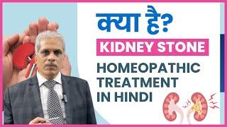 Kidney Stone क्या है? पथरी की होम्योपैथिक दवा | Homeopathic Treatment for Kidney Stone in Hindi