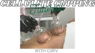 Cellulite Cupping Tutorial | How To Use Cellulite Cupping | Curv Vacuum and Cupping System