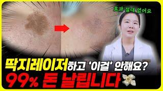 잡티, 흑자, 검버섯 떼고 주의사항? 색소치료 받고 이 영상 안 보면 후회해요!! ㅣ루비레이저,리팟레이저, 엑셀브이, 아꼴레이드 레이저 받고 절대 하면 안되는 주의사항 5가지