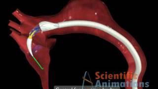 Cardiac animation