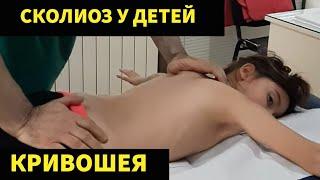 Teen scoliosis treatment by chiropractor Evgeni Trigubov