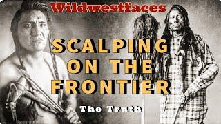 Scalping on the Frontier  - The Truth