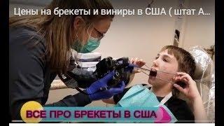 Цены на брекеты и виниры в США ( штат Алабама)