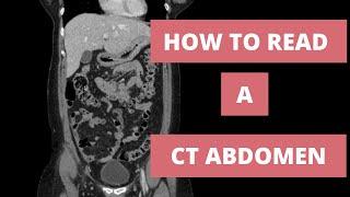How to read a CT Abdomen for Med students and Residents - Part 1