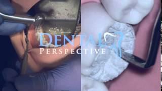 Dental Perspective - Trailer