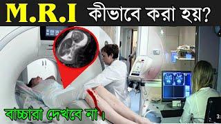 দেখুন (MRI) এম আর আই কিভাবে করা হয় ? What Is MRI Scan