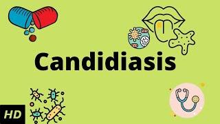 CANDIDIASIS, Causes, Signs and Symptoms, Diagnosis and Treatment.