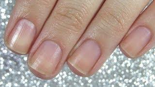 Nail Care For Damaged Nails   WORKS IN A WEEK! GROW NAILS WITH ME  