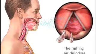 How Do We Cough? - The Mechanism of Coughing - Cough Reflex Animation - Learn Human Body