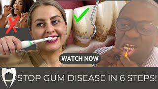 Gum Disease Treatment (2024) | Periodontist's Comprehensive Guide Including Causes and Treatment