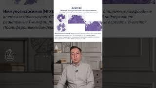 Фолликулярная ЛИМФОМА? #playlistэндоскописта #эндоскопия