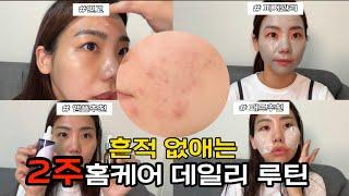 모공,여드름,색소침착 고민이라면? 피부좋은 사람들이 하는 홈케어루틴! 꿀팁! 제품추천! #구독자이벤트