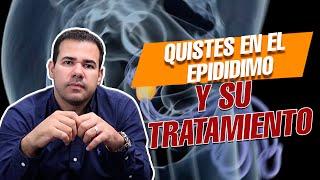 Quistes en los TESTÍCULOS  y su tratamiento