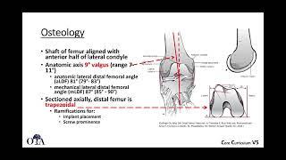 Distal Femur Fractures