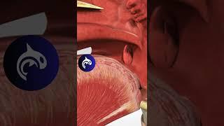 See what Strep Throat looks like in 3D 