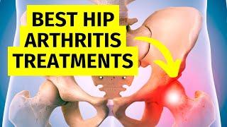 Hip Arthritis Treatments Without Surgery