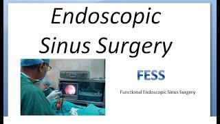 ENT FESS Functional Endoscopic Sinus Surgery Types Indications Uses