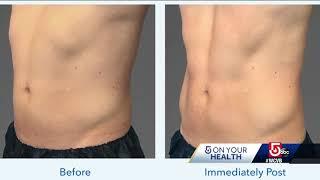 CoolTone By CoolSculpting Phoenix | Scottsdale Arizona - Suddenly Slimmer Med Spa