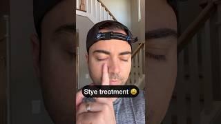 Optometrist gets a stye 