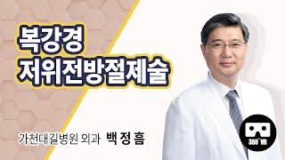 (360˚ VR) 복강경 저위전방절제술 외과 백정흠