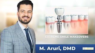 Extreme Smile Makeovers with Dr. M. Aruri | North Haven, CT dentist