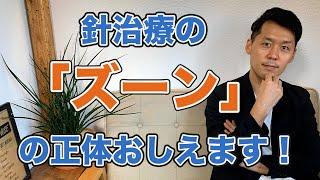 針治療の「ズーン」を鍼灸師がわかりやすく解説します！