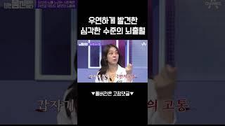 의사의 뇌출혈 썰