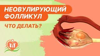 ‍️​ Неовулирующий фолликул / Персистенция фолликула - что делать?