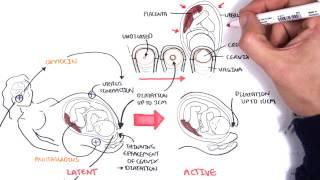 Obstetrics - Stages of Labour