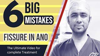 6 BIGGEST MISTAKES in FISSURE ? Watch complete video for best results for pain in Fissure Treatment