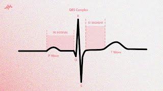 The Cardiac Cycle on an EKG (P-QRS-T Waves)