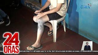 College student, sugatan matapos pumalag sa mga holdaper; walang nakuhang gamit | 24 Oras