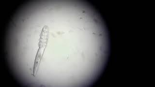 Demodex canis under the microscope - Veterinary Video