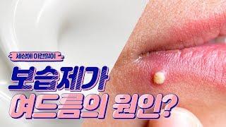 로션, 크림, 수분크림 보습제가 여드름을 유발하는 이유