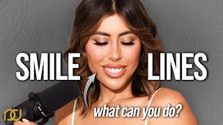 Smile Lines and What You Can Do For Them