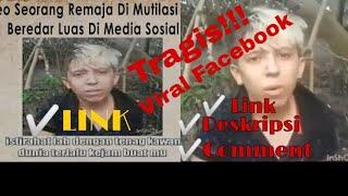 Tragis!!Viral Bocah Di Mutilasi Hidup-Hidup&Link?Ada!