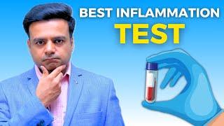 What is Best Inflammation Blood Test