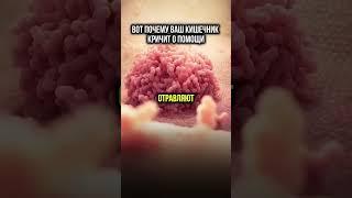 Как кишечник кричит о помощи
