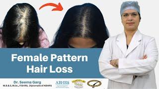 Female Pattern Hair Loss | Dr. Seema Garg