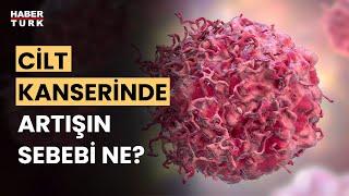 Cilt kanserinden nasıl korunmalıyız? Prof. Dr. Ömer Özkan anlattı