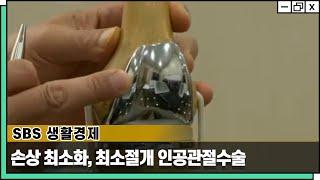 손상 최소화! 최소절개 인공관절수술 [SBS 생활경제 방송 - 웰튼병원 송상호 병원장]