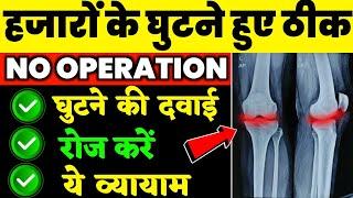 घुटनों की दवा है यह एक्सरसाइज, सर्जरी  से बचें|Knee Pain Exercises|Knee Gap Exercises