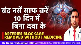 ARTERIES  BLOCKAGE REMOVED WITHOUT MEDICINE// बंद नसें साफ करें 10 दिन में  बिना दवा के