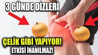 Bir Soğan 3 Günde Diz Ağrısını Yok Edip Çelik Gibi Yapıyor!