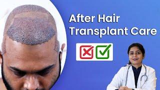 How To Take Care After Hair Transplant Surgery ?